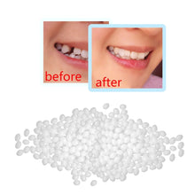 Load image into Gallery viewer, 10g Denture Solid Glue Dental Restoration Temporary Tooth Repair Kit Teeth And Gaps FalseTeeth Solid Glue Denture Adhesive #40